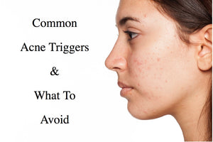 Common Acne Triggers And What To Avoid